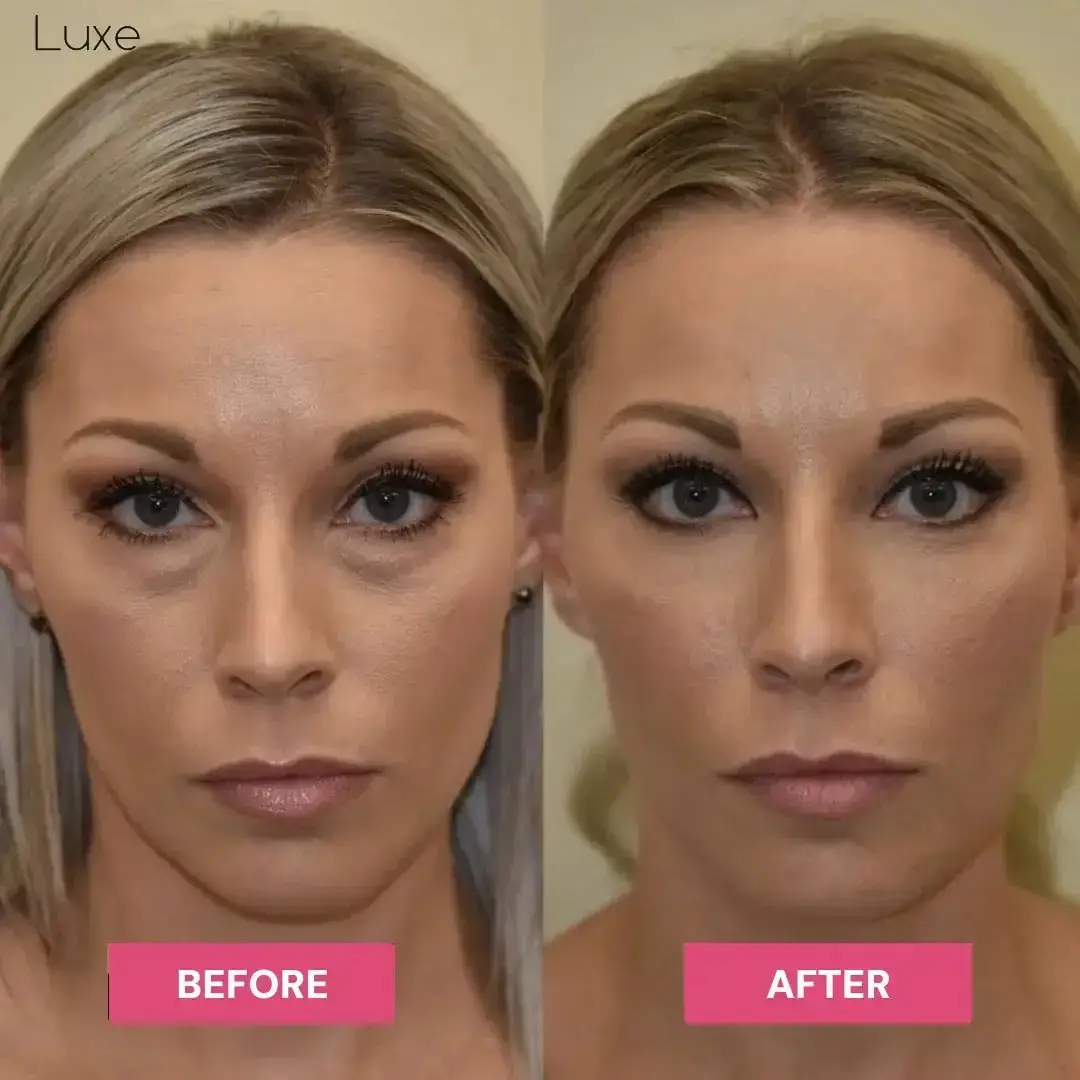 Luxe - Korean Under-Eye Balm - Image 9